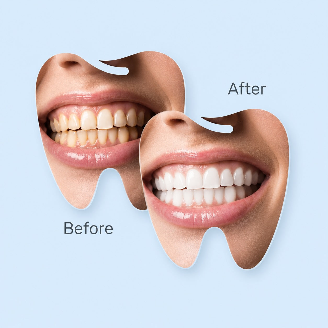 Nano-Hydroxyapatite Toothpaste